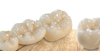 Dental-Treatment-Dental-Crown-and-Bridge teeth crown and bridge