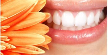 Dental-Treatment-Professional-Whitening-Zoom teeth whitening hamilton