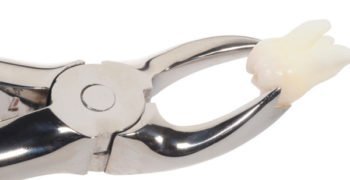 Dental-treatment-Oral-Surgery–Extraction Dental-treatment-Oral-Surgery–Extraction