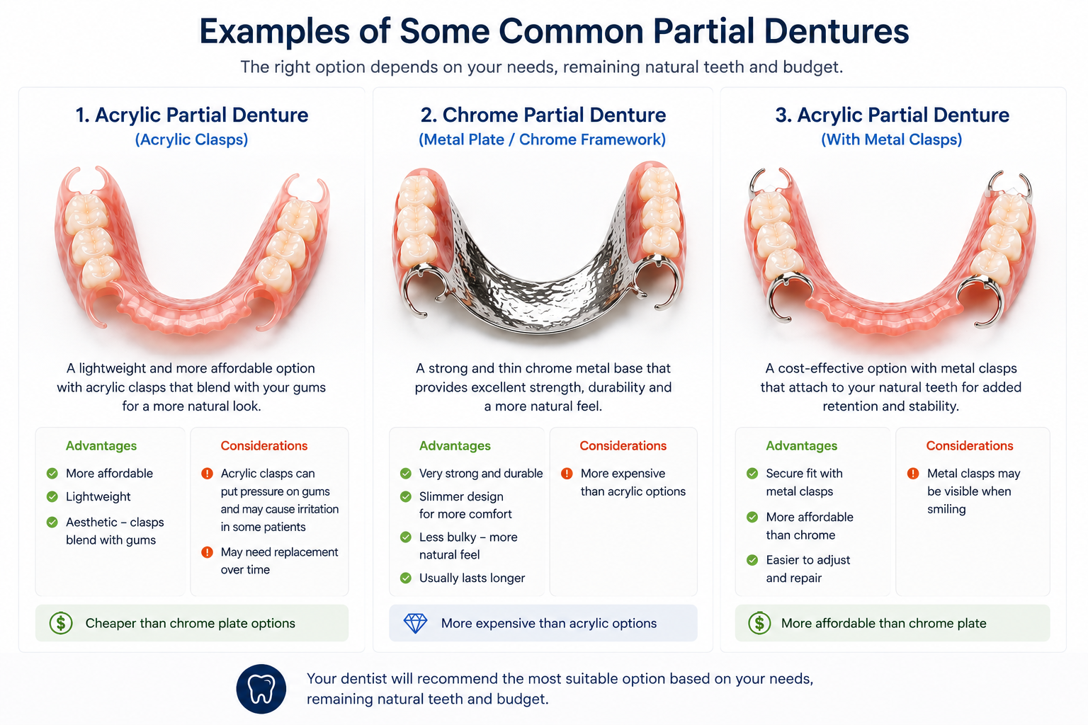 Examples of acrylic and chrome partial dentures in Hamilton