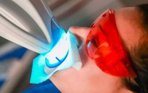 Teeth Whitening Dentist Hamilton Relax Dental